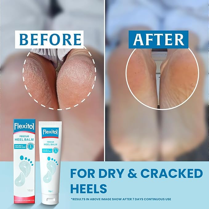 Flexitol Heel Balm